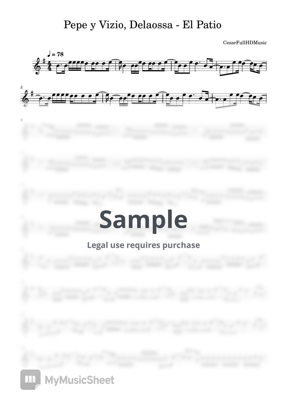 Pepe y Vizio, Delaossa El Patio Sheets
