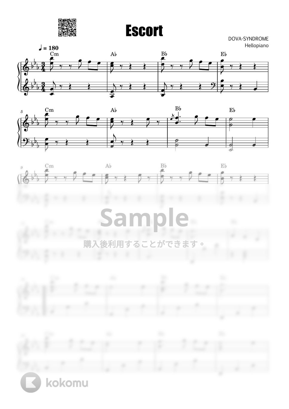 dova-syndrome - escort by hellopiano