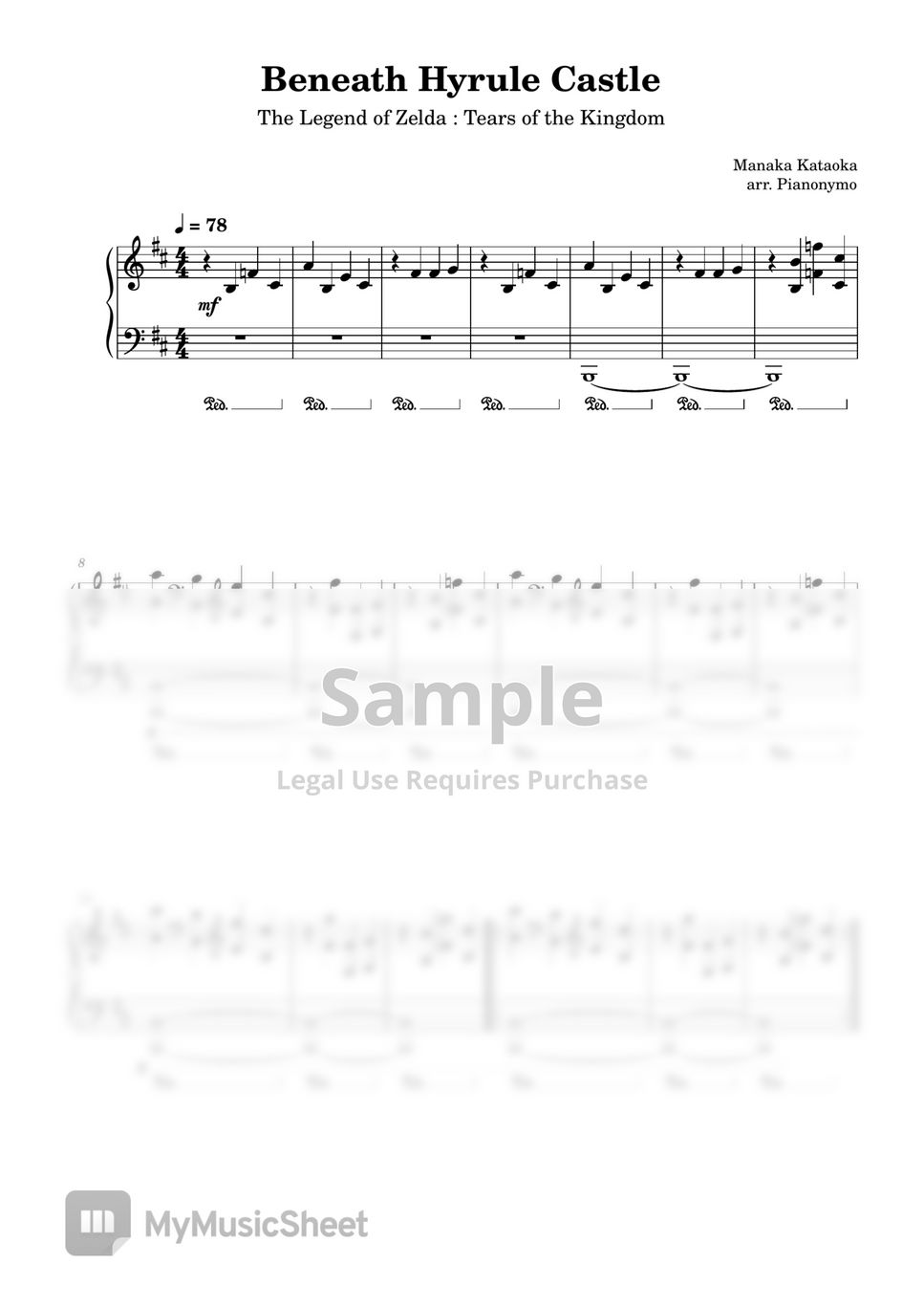 Manaka Kataoka BENEATH HYRULE CASTLE (Prologue) Zelda Tears of